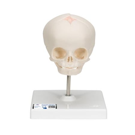 Fetal Skull, On Stand - W/ 3B Smart Anatomy